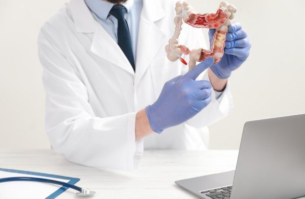 Especialidad en Cirugía Gastrointestinal y Coloproctología para tratar Pólipos en colon en CDMX y Naucalpan