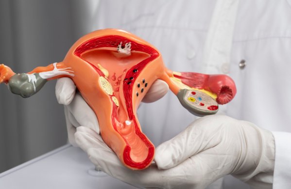 Tratamiento del VPH en CDMX y Naucalpan
